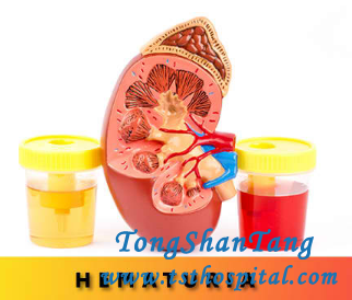 Treatment for 2+ Blood In Urine From FSGS