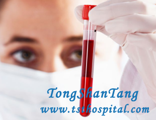 Four Sign of Urine Indicates Kidney Diseases
