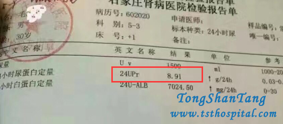 24h Upr Reduces and Hematuria Becomes Negative In Our Hospital