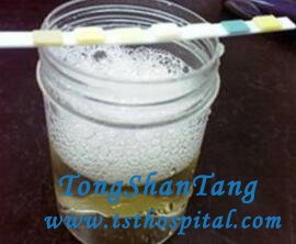 Cure Protein Urine In Natural Treatment