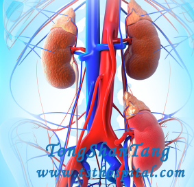 Two Kidney Transplant, IgA Nephropathy Relapses Again
