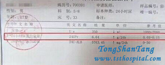 How Does Your Hospital Treat Proteinuria In Nephrotic Syndrome