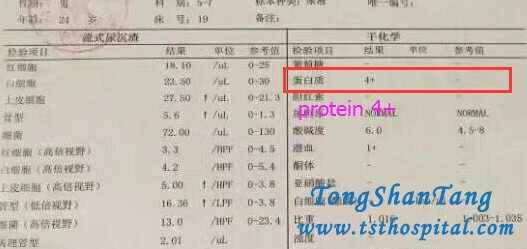 Chinese Medicine Treatments Can Control IgA Nephropathy Radically