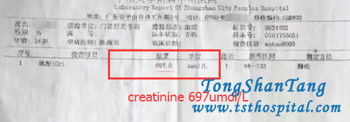 Chinese Medicine Treatments Can Control IgA Nephropathy Radically