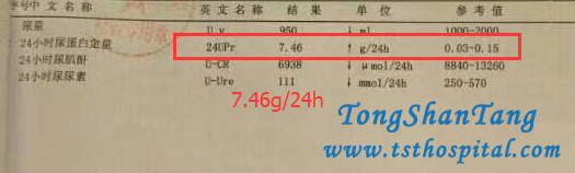 Treatment for Nephrotic Syndrome 