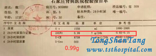 Treatment for Nephrotic Syndrome 