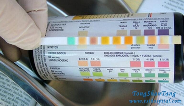 How to Treat Protein Urine in Diabetic Nephropathy with Natural Treatment