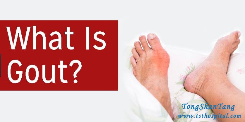 How to Prevent Gout Through Diet