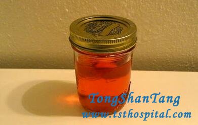 Can Blood in Urine Get Cured in Nephrotic Syndrome with Natural Treatment