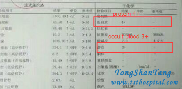 Treatment for CKD without steroids 