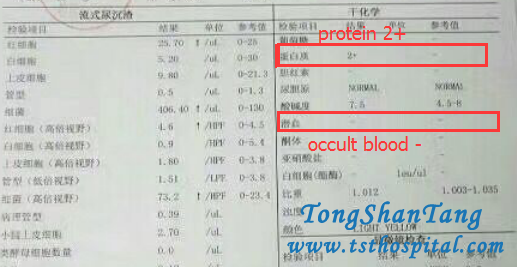 Treatment for CKD without steroids 