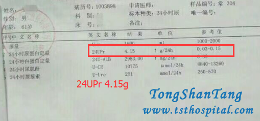 Why Does Swelling Relapse In Nephrotic Syndrome