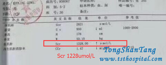 How To Treat Gouty Nephropathy Effectively