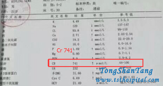 How To Treat Gouty Nephropathy Effectively