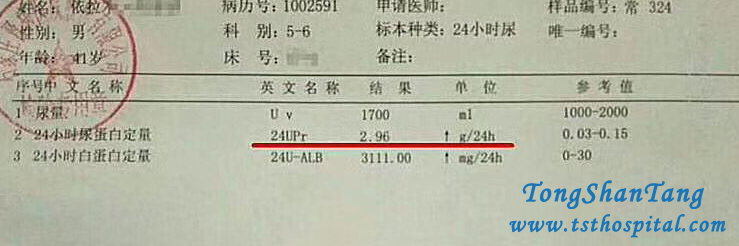 How To Eliminate Proteinuria In Membranous Nephropathy Effectively