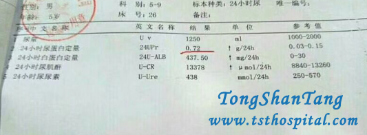 Proteinuria In Lupus Nephritis Is Reduced Effectively In Our Hospital