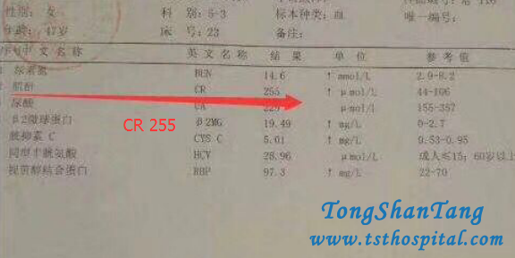 No Dialysis, How To Reduce High Creatinine Level 700umol/L