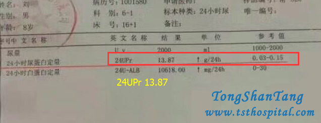 Chinese Medicines Help You Avoid Relapse of Proteinuria