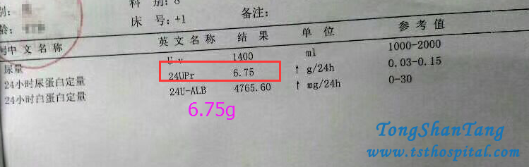 How To Deal With Proteinuria 6.75g In Diabetic Nephropathy