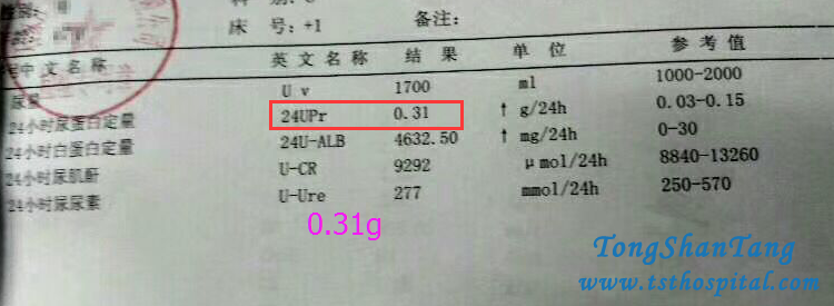 How To Deal With Proteinuria 6.75g In Diabetic Nephropathy