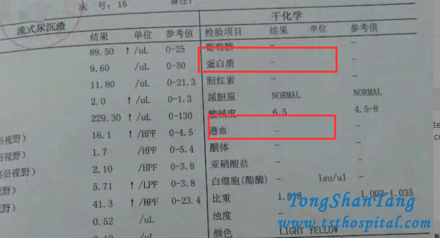 Toxin-Removing Treatment Works for IgA Nephropathy Effectively