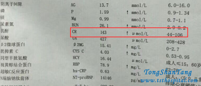 Kidney Failure With High Creatinine Level 509umol/L: No Dialysis