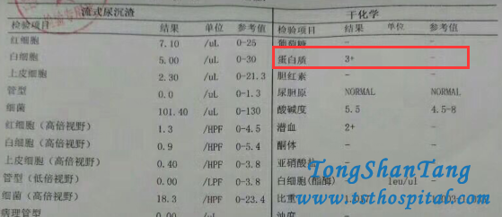 Toxin-Removing Treatment Help You Avoid IgA Nephropathy
