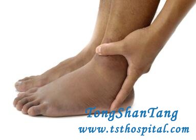 How to Prevent Swelling Because of Diabetic Nephropathy