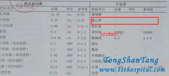 Toxin-Removing Treatment Make Proteinuria Negative In Nephrotic Syndrome