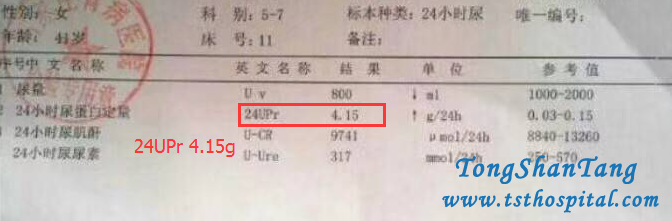 Chinese Medicines Treat Proteinuria 4.15g In Membranous Nephropathy