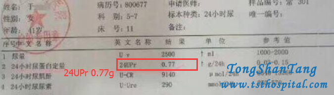 Chinese Medicines Treat Proteinuria 4.15g In Membranous Nephropathy