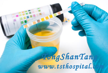 Can Proteinuria In Nephrotic Syndrome Be Only Treated By Steroids