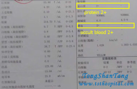 Chinese Medicines Make Protein 2+ and Occult Blood 2+ Negative In Purpura Nephritis