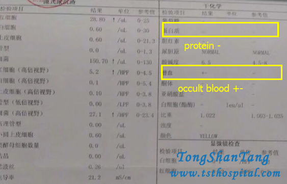 Chinese Medicines Make Protein 2+ and Occult Blood 2+ Negative In Purpura Nephritis