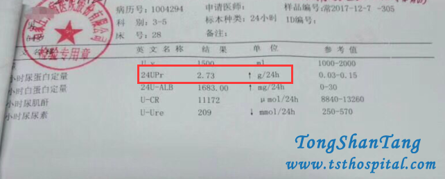 Detoxification Therapy Treats Membranous Nephropathy Effectively