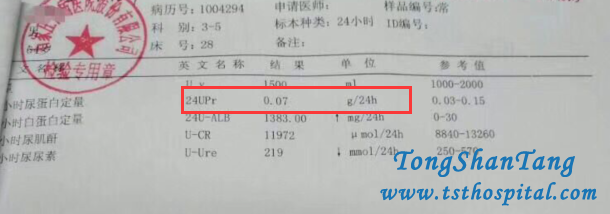 Detoxification Therapy Treats Membranous Nephropathy Effectively