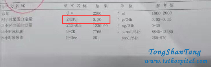Chinese Medicine Treatments Are Amazing To Nephrotic Syndrome