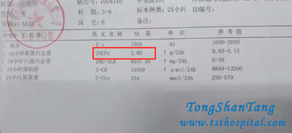 Chinese Medicine Treatments Are Amazing To Nephrotic Syndrome