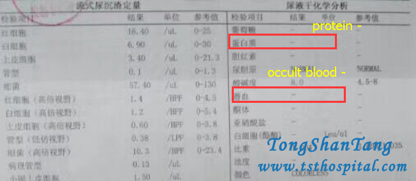 Hematuria 3+ Becomes Negative In IgA Nephropathy
