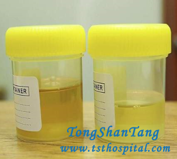 Alternative Medicine for Lupus Nephritis Patients to Lower Proteinuria