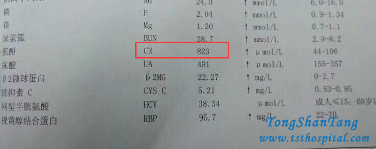 Detoxification Therapy Reduces High Creatinine Level 823 Effectively