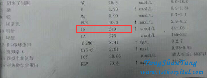 Detoxification Therapy Reduces High Creatinine Level 823 Effectively