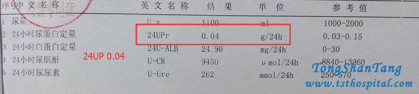 Detoxification Therapy Manages Lupus Nephritis Effectively