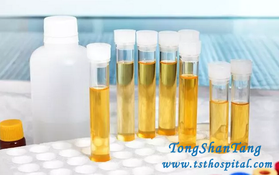 3 Principles of Medicine Prevent Kidney Disease Getting Relapse And Aggravation