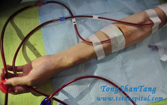 3 Principles of Medicine Prevent Kidney Disease Getting Relapse And Aggravation