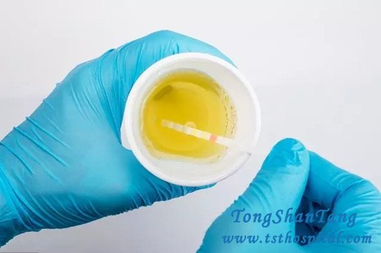 To Prevent Uremia, the Following 3 Aspects Should Be Done