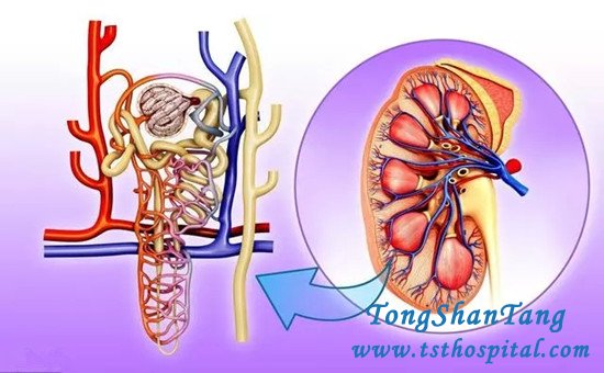 To Prevent Uremia, the Following 3 Aspects Should Be Done