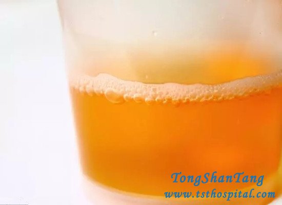 To Prevent Uremia, the Following 3 Aspects Should Be Done