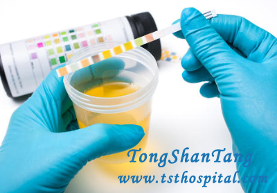 Proteinuria 2+ and Lupus: What Does It Imply