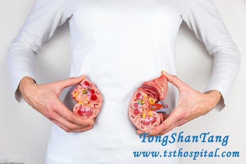 How to Treat PKD? There Are 4 Options